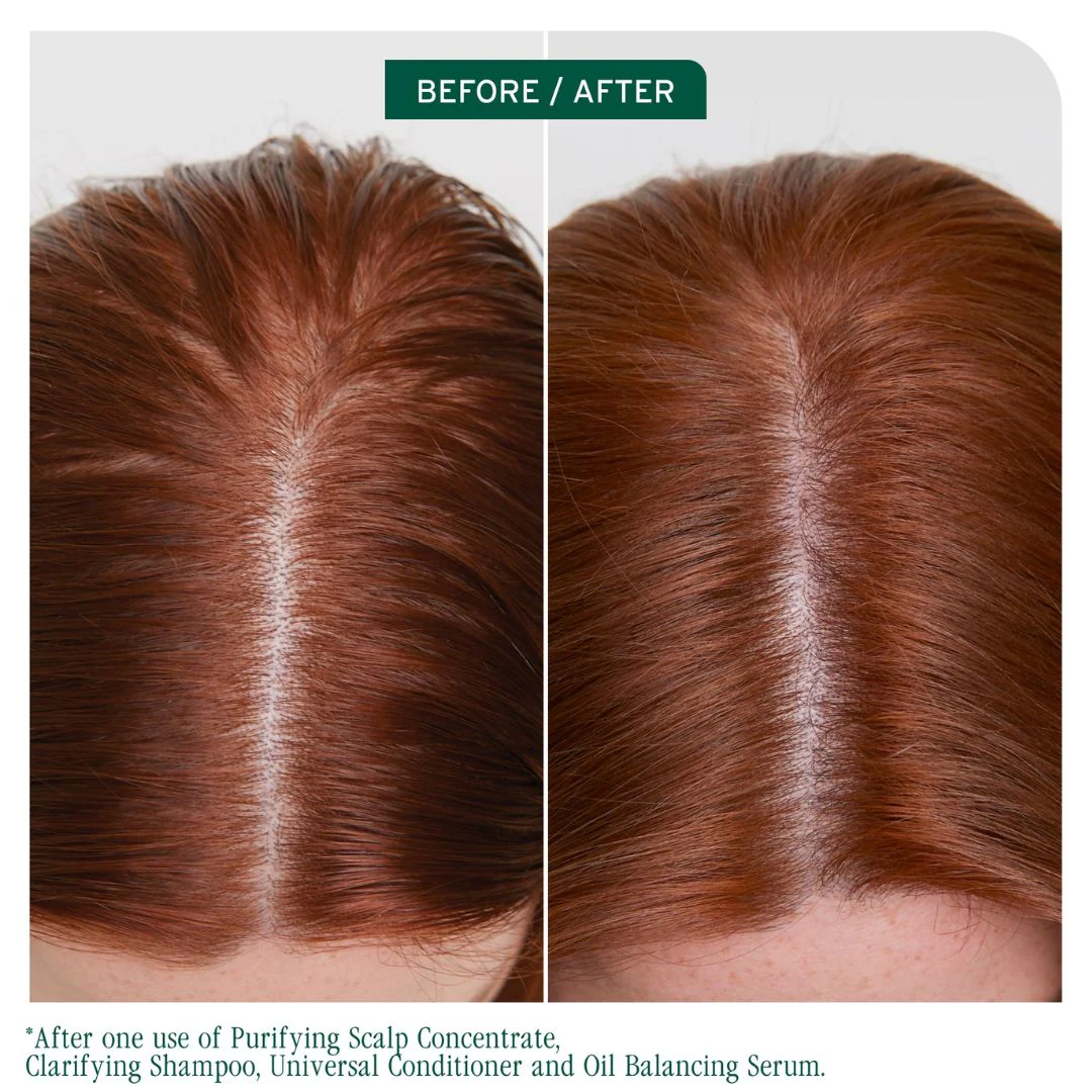 Biolage Scalp Sync Clarifying Shampoo 400ml - Image 5