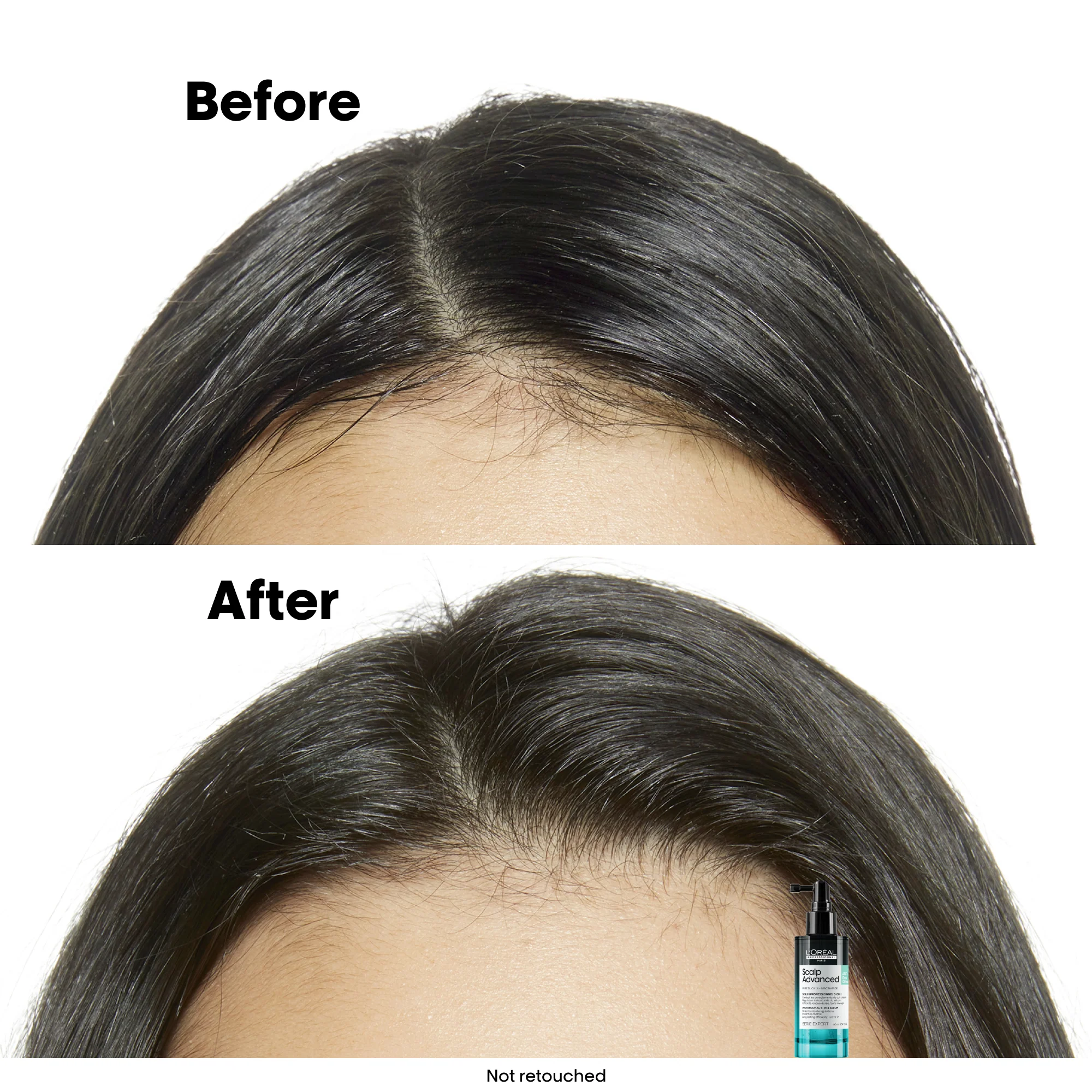 L'Oréal Professionnel Scalp Advanced Anti-Oily Spray 90ml - Image 7